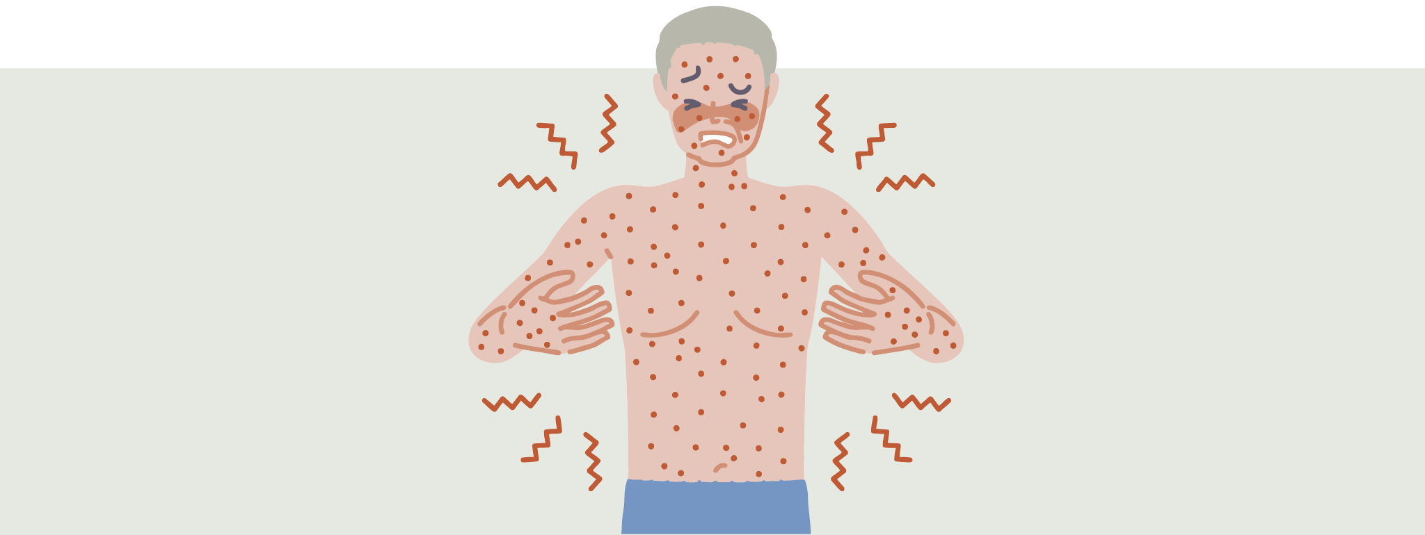 Histamine en andere biogene aminen